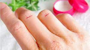 CREMA DI UREA AL 30% – 500 ml – ARANCIA